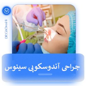 جراحی آندوسکوپی سینوس _ دکتر جابر قرشی
