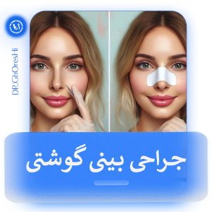 جراحی بینی گوشتی در تهران - دکتر جابر قرشی